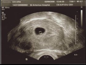 02.09.2008.JPG