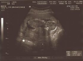 05.11.2008.JPG