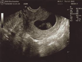 19.09.2008.JPG